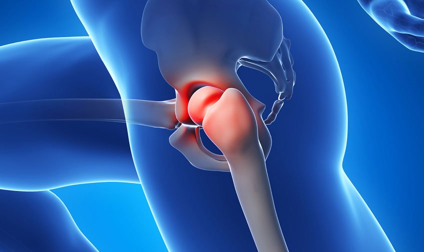 Hip Arthroscopy