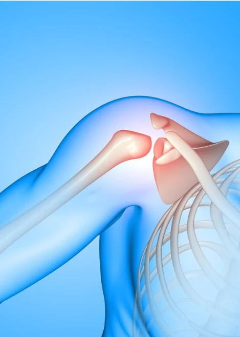 Shoulder Arthroscopy